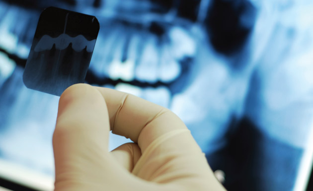 dental-xray